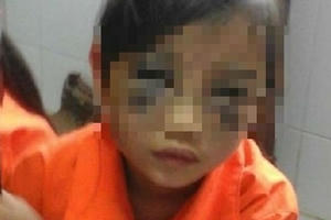 Lào Cai: Cô giáo đánh học sinh tiểu học, cơ quan chức năng đã vào cuộc