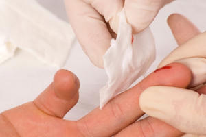 Làm gì khi có nguy cơ phơi nhiễm HIV?