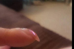 Nếu móng tay cong quặp xuống, đến bệnh viện ngay! Nếu móng tay cong quặp xuống, đến bệnh viện ngay!