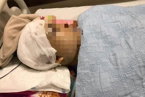 Hải Dương: Phó Chủ tịch UBND xã bị đánh chấn thương sọ não khi thực hiện nhiệm vụ