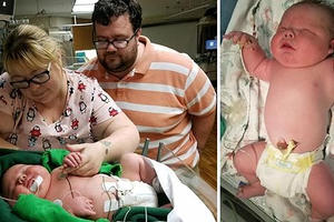 Bé sơ sinh nặng gần 6,7 kg