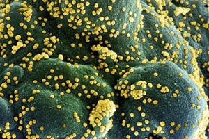 Phát hiện biến thể mới của virus SARS-CoV-2 chứa 46 đột biến