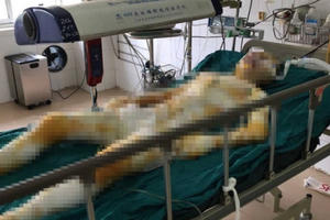Làm rõ nghi án cô gái bị thiêu sống tại Vĩnh Phúc