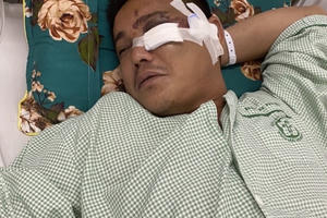 Bắc Giang: Người đàn ông bị nhóm thanh niên lao vào hành hung gãy xương gò má, khâu 28 mũi