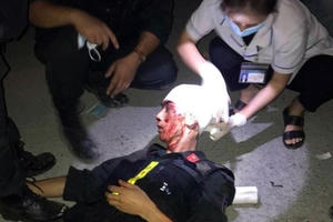 Chiến sĩ công an bị đối tượng quá khích tấn công gây thương tích