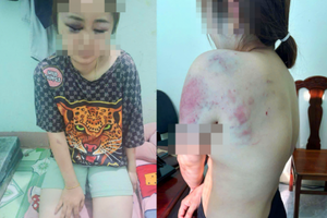 Vụ người đàn ông đánh vợ sắp cưới suốt 13 tiếng: Hé lộ nguồn cơn