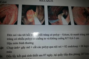 Giật mình với em bé 10 tuổi có tới 30 polyp đường tiêu hóa