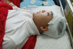 Nam sinh lớp 11 bị bạn cùng trường đánh vỡ sọ não bằng gậy sắt