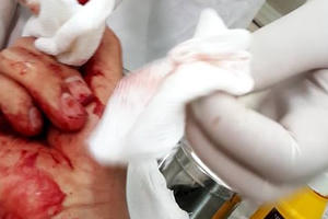 Phó Thủ tướng chỉ đạo làm rõ đối tượng hành hung nhà báo Đỗ Doãn Hoàng