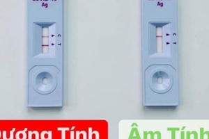 Test nhanh 2 vạch càng đậm chứng tỏ bệnh càng nặng?