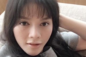 Lý Nhã Kỳ lên tiếng bác bỏ lời đồn thổi “phẫu thuật thẩm mỹ”