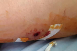 Nghệ An: "Cẩu tặc" liều lĩnh rút súng bắn người dân khi bị phát hiện trộm chó