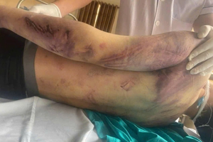 Tạm giữ nhóm người liên quan vụ học viên 17 tuổi tử vong tại Trung tâm Công tác xã hội