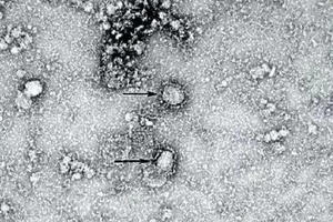 Chuyên gia Australia nuôi cấy thành công chủng coronavirus mới