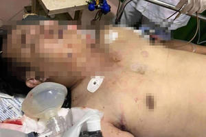 Đồng Nai: Ngồi trong nhà, một người đàn ông nghi trúng đạn tử vong