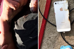Điện thoại phát nổ khi vừa sạc vừa chơi game, bé trai bị dập nát bàn tay