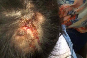 Thông tin mới vụ dì ruột đánh cháu 4 tuổi bầm tím khắp người ở Hà Tĩnh Thông tin mới vụ dì ruột đánh cháu 4 tuổi bầm tím khắp người ở Hà Tĩnh