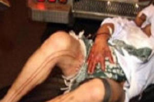 Đang nằm ngủ, bị bạn nhậu cắt đứt ‘của quý’