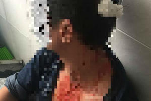 Kỳ 3 - Bệnh viện 115 đưa thiếu hồ sơ bệnh án để công an giám định thương tích?