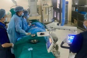 Loại bỏ khối u gan lớn đến 6cm không cần phẫu thuật