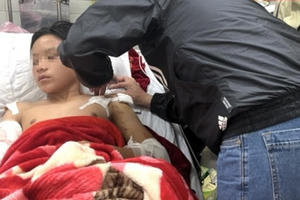 Bị xử phạt 1,5 triệu đồng vì không đeo rọ mõm cho chó