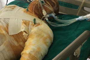 Kẻ tưới xăng “thiêu sống” đồng nghiệp cũ bị khởi tố về tội “Giết người”