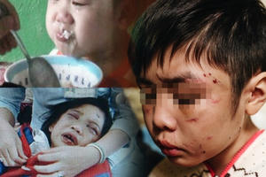 Tăng cường các giải pháp bảo vệ trẻ em