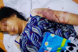 Cô gái 18 tuổi bị đánh sảy thai chỉ vì khoản nợ 1,6 triệu đồng của anh