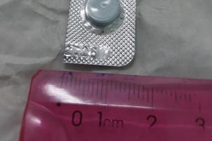 Bé trai bất cẩn nuốt viên thuốc còn nguyên vỏ có 3 đầu sắc nhọn