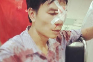 Nghệ An: Cán bộ địa chính xã Quỳnh Bá bị tố dùng xẻng đánh gục người đàn ông sau va chạm giao thông