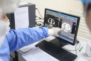 Một  nữ bệnh nhân nhiễm Covid-19 diễn biến nặng phải đặt ECMO