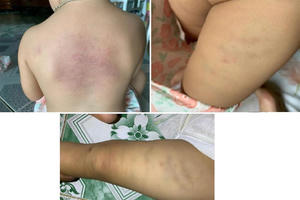 Công an vào cuộc điều tra, làm rõ vụ việc trẻ em bị bạo hành tại một nhà trẻ tư thục