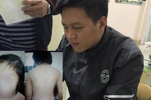 Ngày mai (31/8), xét xử vụ cha đẻ cùng mẹ kế đánh con như thời trung cổ