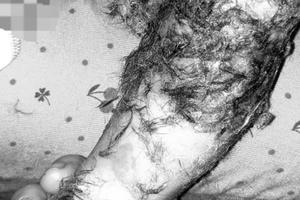 "Thầy lang” đắp lông động vật để chữa bỏng cho trẻ