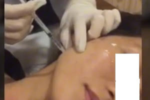 TPHCM: Hiểm họa từ làm đẹp siêu tốc: Nghi vấn cơ sở Yanhee Clinic & Spa thẩm mỹ chui hàng loạt dịch vụ?