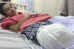 Sở Y tế Đắk Lắk không mời người nhà nữ sinh bị cưa chân đến dự buổi xin lỗi