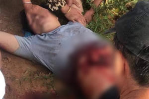 Kinh hoàng: Người đàn ông tự dùng dao rạch bụng vì nghĩ có bom bên trong