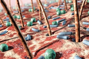 Tiềm ẩn nhiều nguy cơ bệnh tật từ mũ bảo hiểm