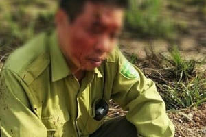 Đắk Lắk: Khởi tố đối tượng ném khúc tre vỡ đầu cán bộ kiểm lâm