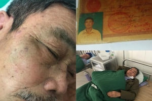 Hà Nội: Cán bộ xã hành hung người dân gây thương tích