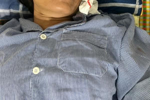 Bắc Giang: Một phụ nữ bị hành hung dã man tại nhà riêng ở huyện Việt Yên