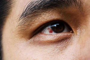 3 đốm đen xuất hiện trên cơ thể cảnh báo bệnh tật