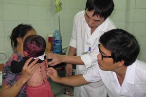 Dịch thủy đậu bùng phát, bác sĩ lưu ý cách phòng và điều trị Dịch thủy đậu bùng phát, bác sĩ lưu ý cách phòng và điều trị