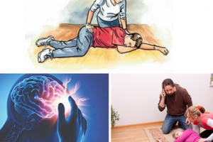 Phòng ngừa đột quỵ mùa lạnh Phòng ngừa đột quỵ mùa lạnh