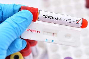 Chi bộn tiền… mua sự lãng phí