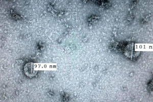 Việt Nam nuôi cấy và phân lập thành công virus Corona mới