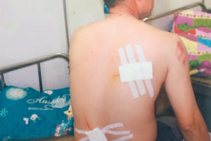 Ninh Bình: Phụ xe côn đồ, cầm kiếm chém người trọng thương tại bến xe