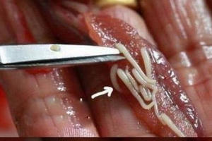 5 món ăn chứa nhiều ký sinh trùng đáng sợ nhất