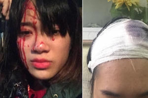 Hà Nội: Xôn xao hình ảnh cô gái bị hai nam thanh niên trêu ghẹo, đánh vỡ đầu Hà Nội: Xôn xao hình ảnh cô gái bị hai nam thanh niên trêu ghẹo, đánh vỡ đầu