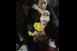 Bác sĩ nói gì về hiện tượng bé trai nghi phát bệnh dại kêu "oắc oắc"? Bác sĩ nói gì về hiện tượng bé trai nghi phát bệnh dại kêu "oắc oắc"?